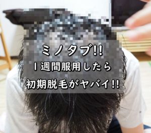 【ハゲ画像】ミノタブを1週間服用したら初期脱毛が!!スカスカ写真公開!!
