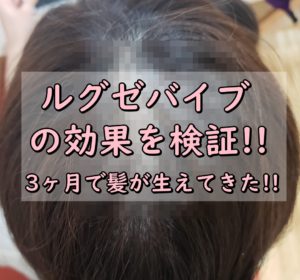 【薄毛画像】ルグゼバイブの効果を検証!!3ヶ月で髪が生えてきた♪