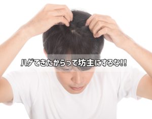 【薄毛】ハゲてきたからって坊主にするな!!ミノタブで髪が復活!?